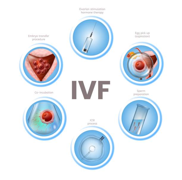 IVF Treatment