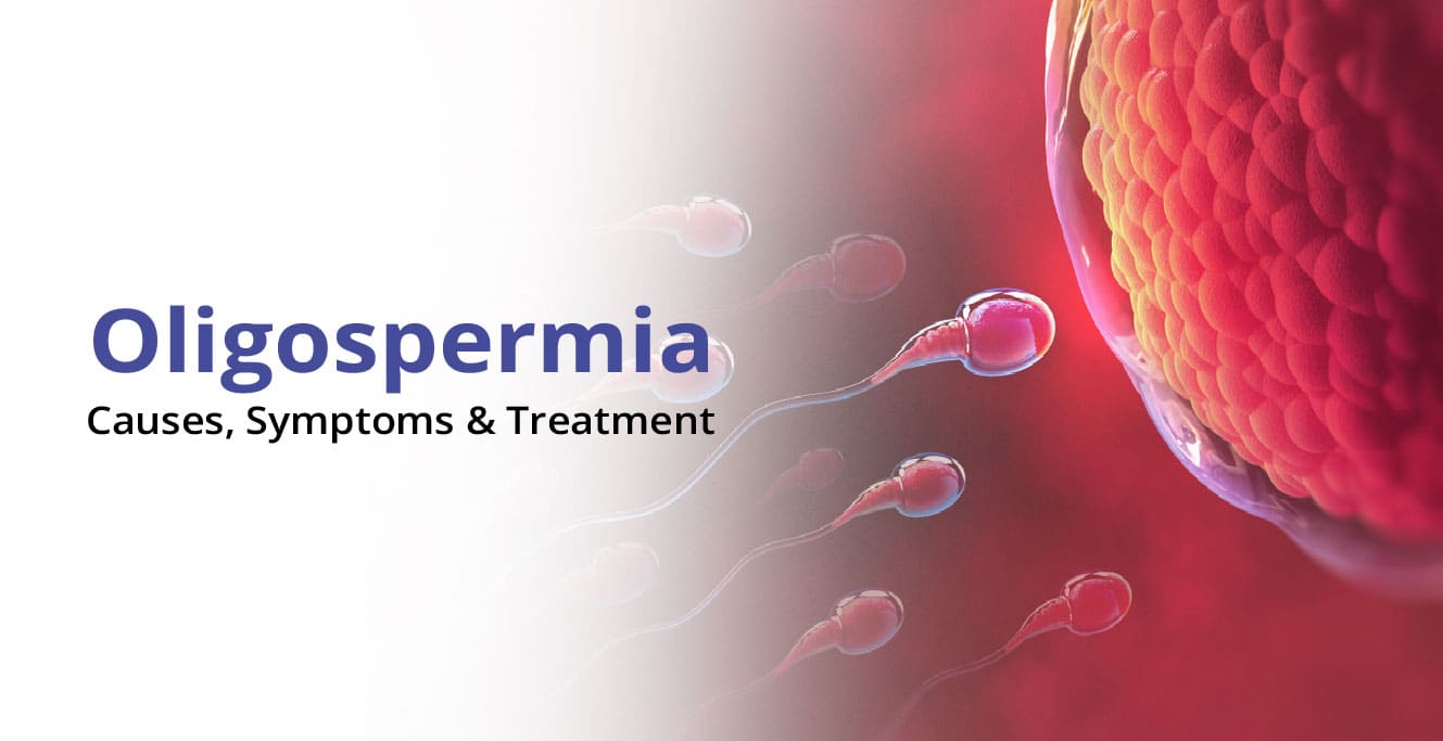 Oligospermia Treatment