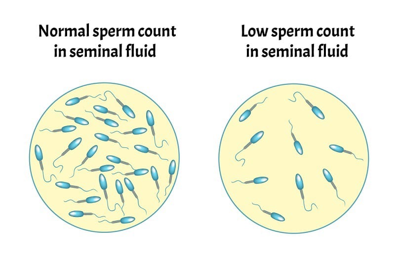 Low Sperm Count