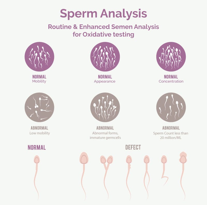 Semen Analysis and Culture