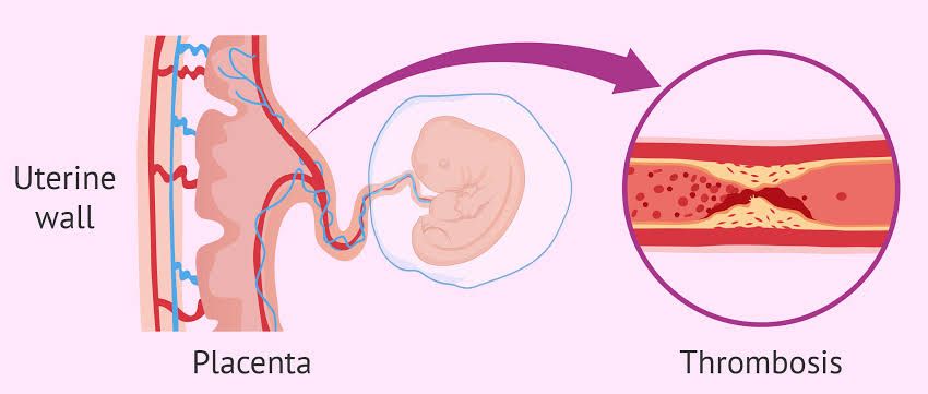 Immune Fertility Testing