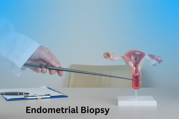 Endometrial Biopsy for Infertility Treatment