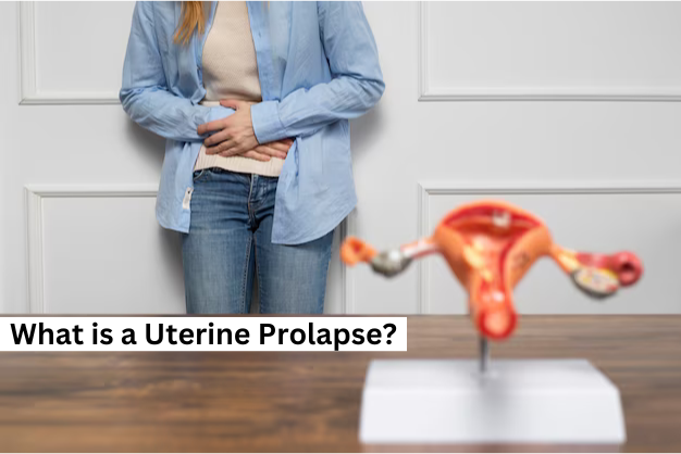 What is a Uterine Prolapse?