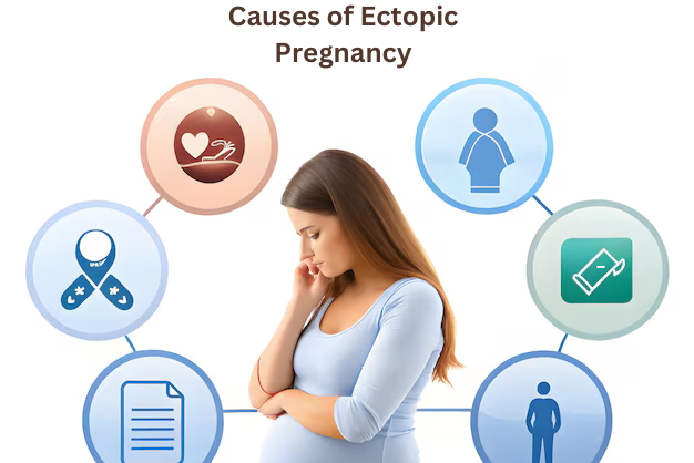 Causes of Ectopic Pregnancy