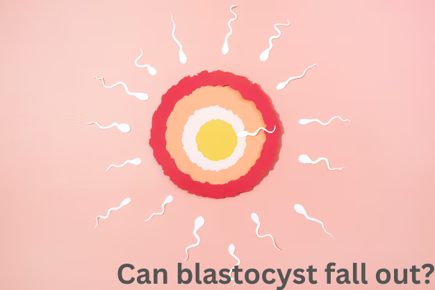 Can blastocyst fall out?