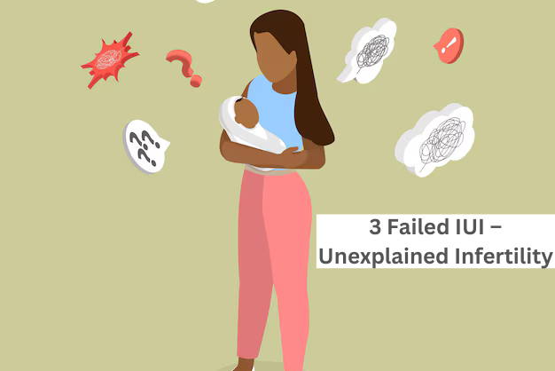 3 Failed IUI – Unexplained Infertility