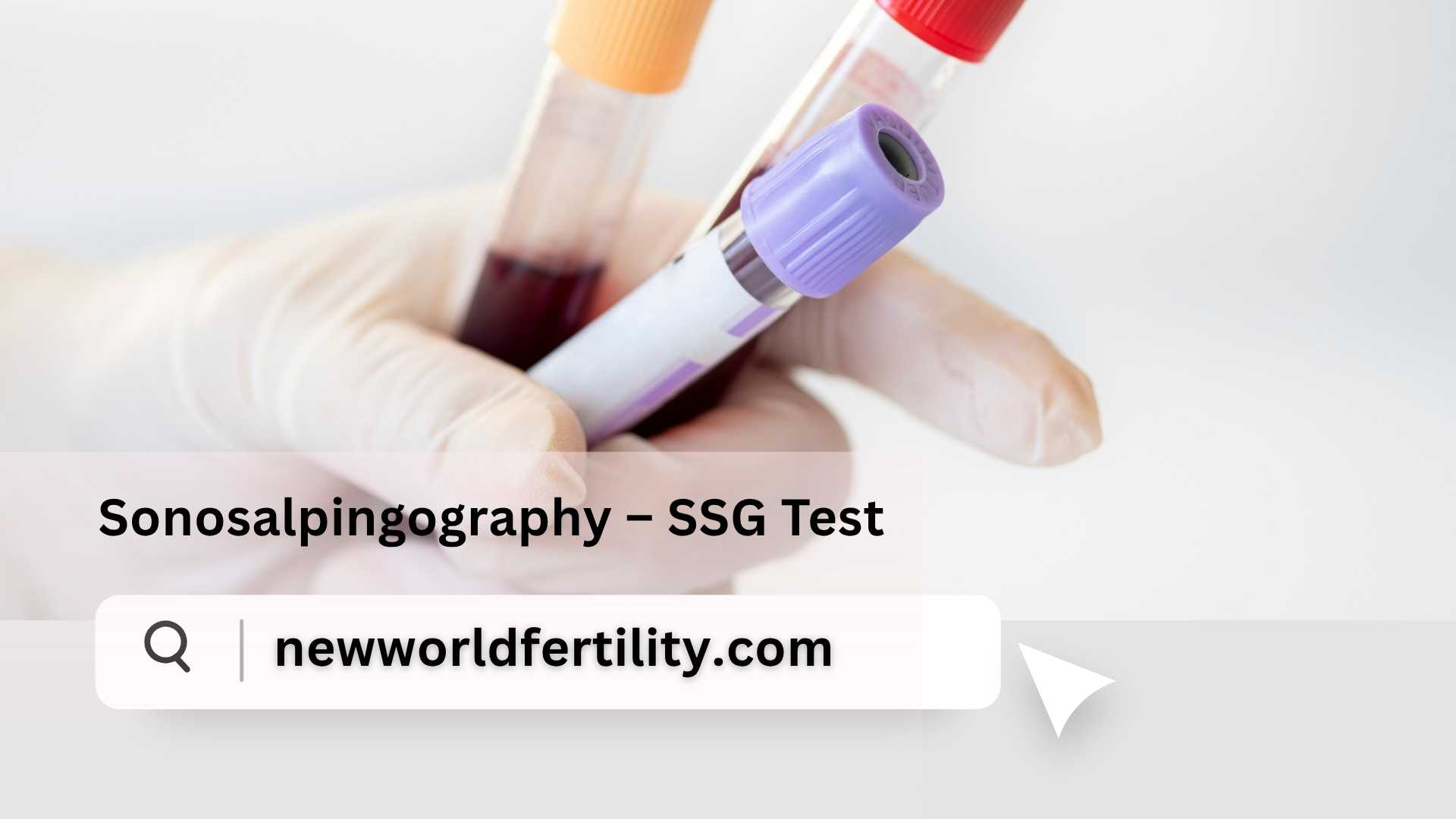 Sonosalpingography – SSG Test, Procedure, Cost & Advantages in 2025
