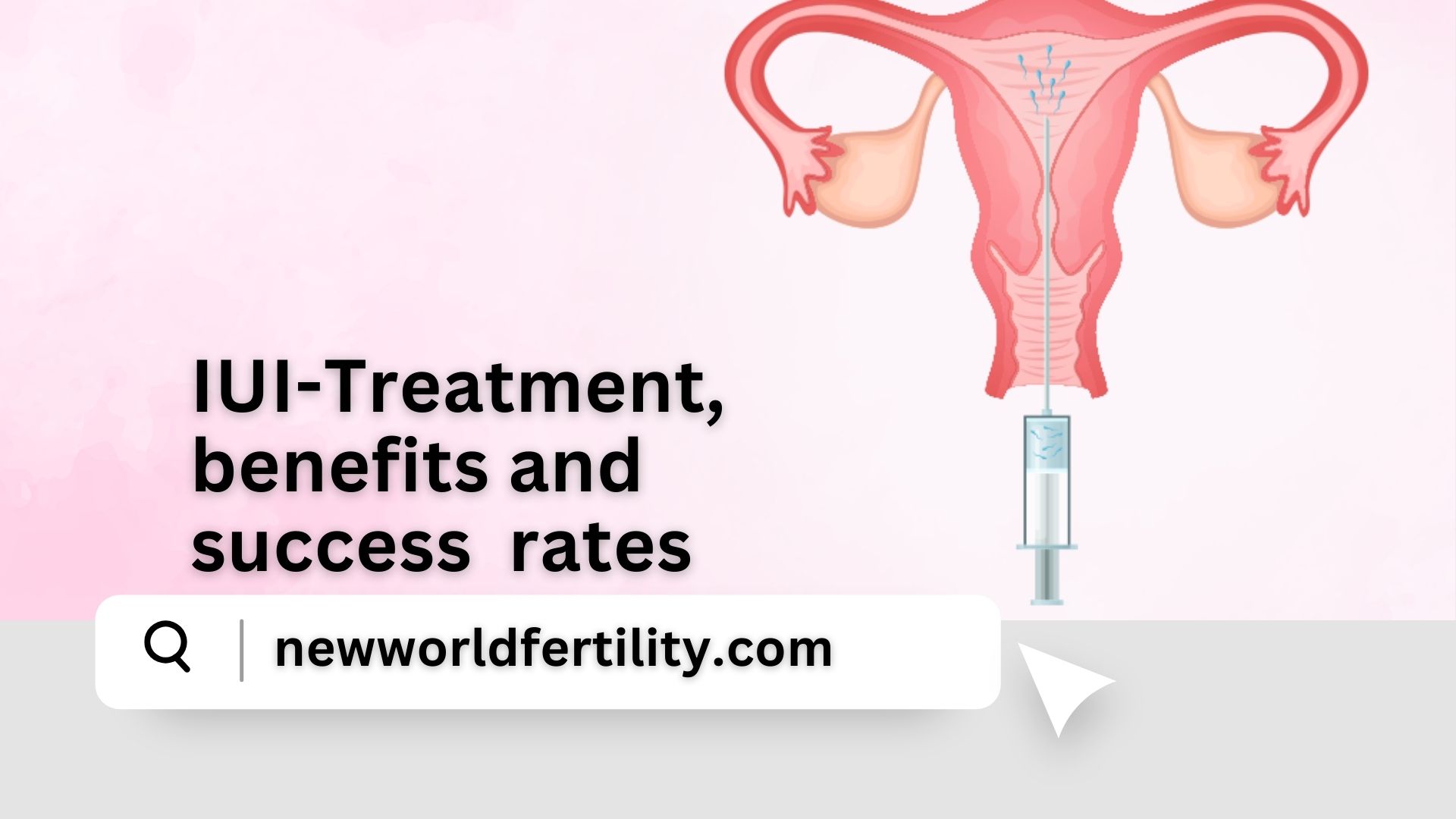 IUI Treatment: Success Rates, Procedure, Costs & Everything You Need to Know