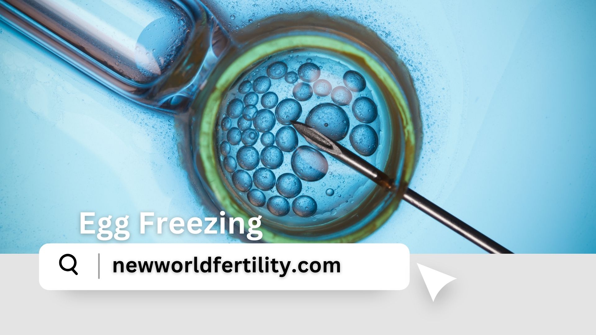 Egg Freezing: 10 Essential Things to Consider Before Preserving Your Fertility