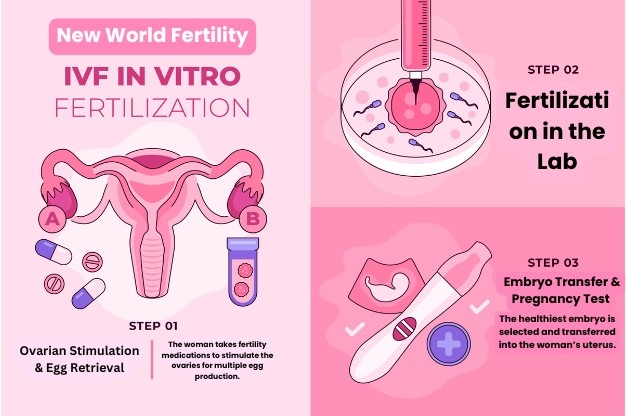 Best IVF Center in Delhi | New World Fertility