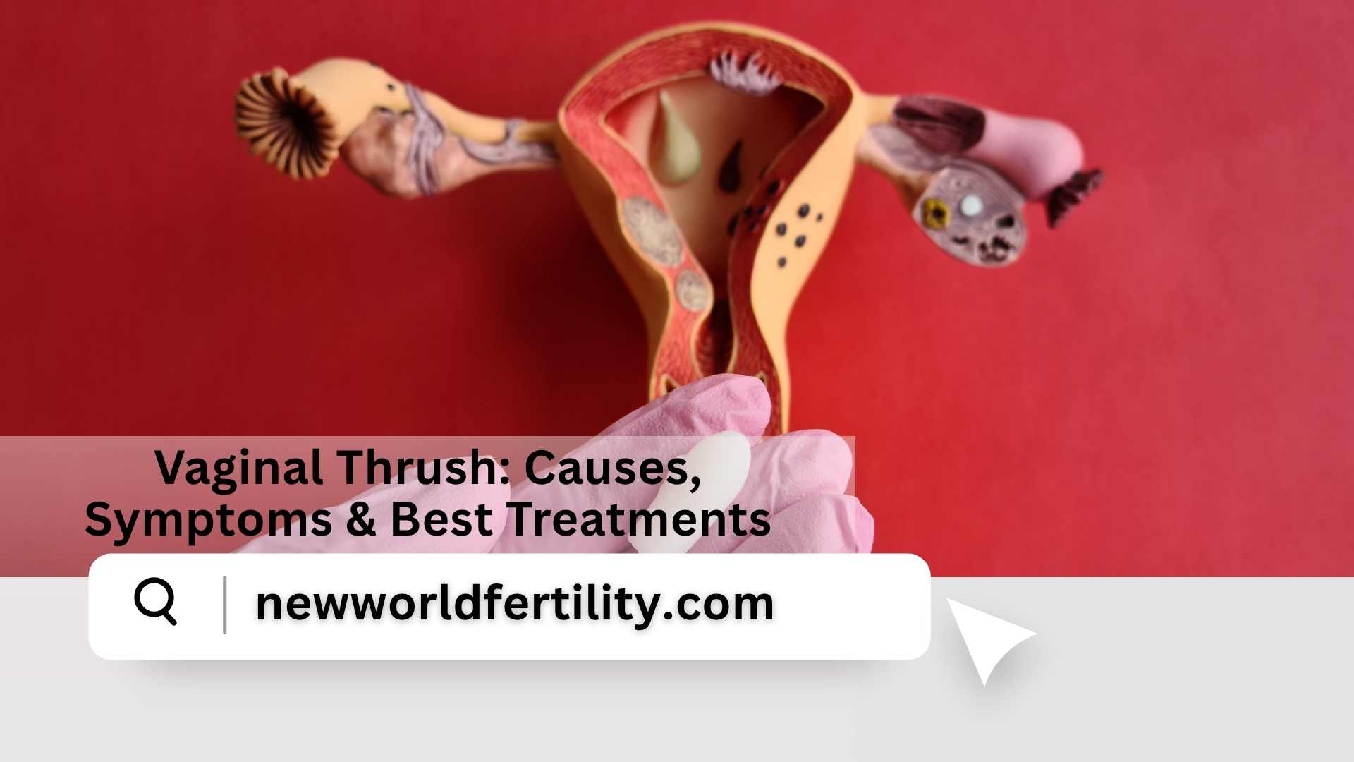 Vaginal Thrush: Causes, Symptoms & Best Treatments