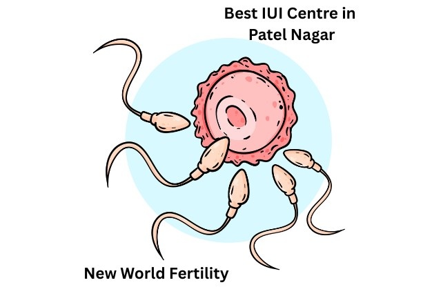 Best IUI Centre in Patel Nagar: Cost, Success Rates in 2025
