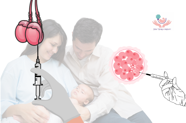 TESA: A Breakthrough in Male Fertility Treatment