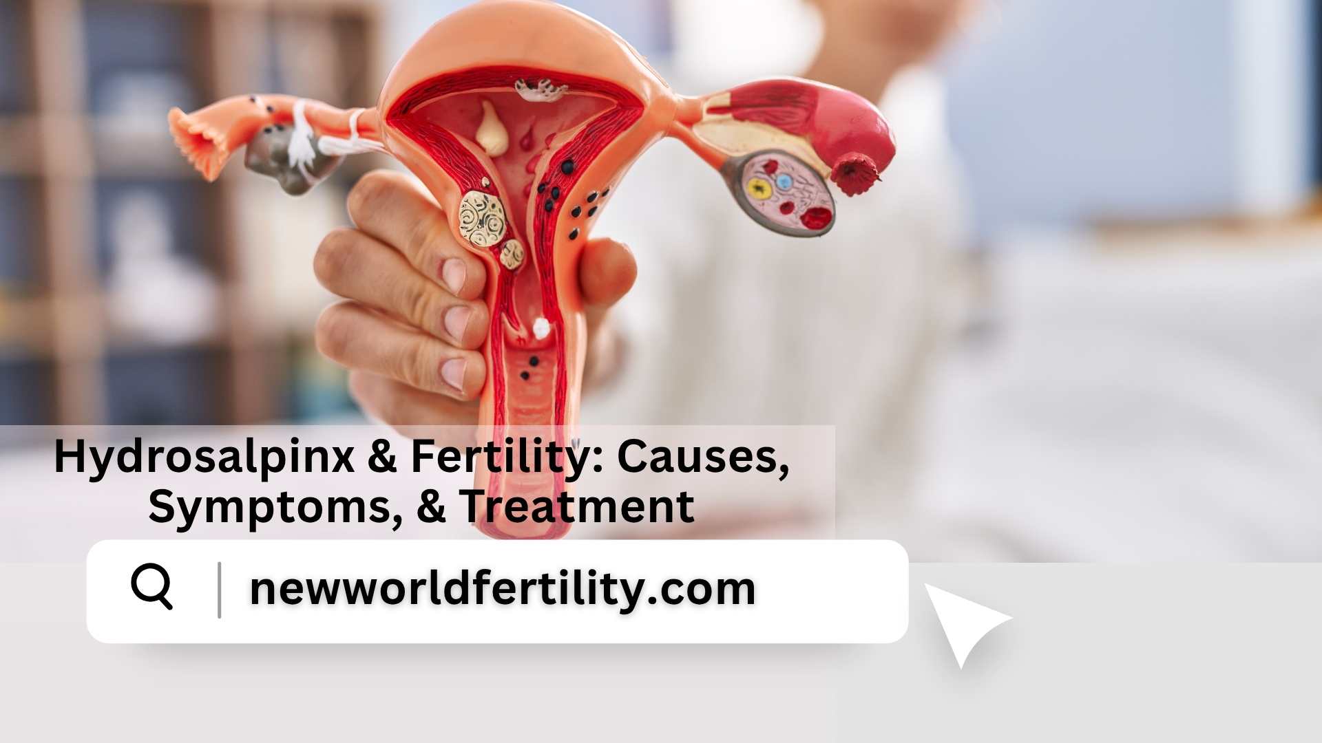 Hydrosalpinx: A Complete Guide to Causes, Symptoms, and Its Impact on Your Fertility