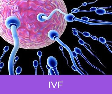 IVF with ICSI Treatment