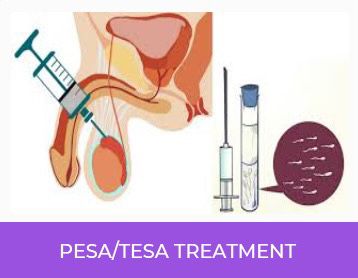 PESA/TESA Treatment