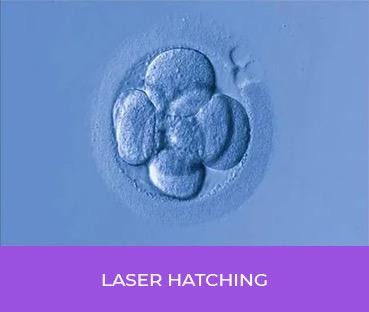 Laser Hatching Treatment