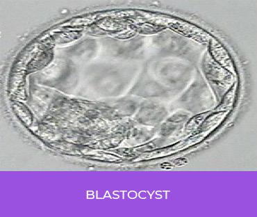 Blastocyst Treatment