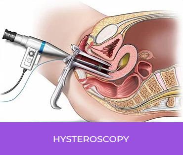 Hysteroscopy/laparoscopy Treatment